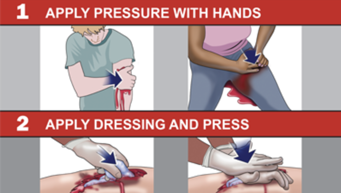 How To Stop Severe Bleeding