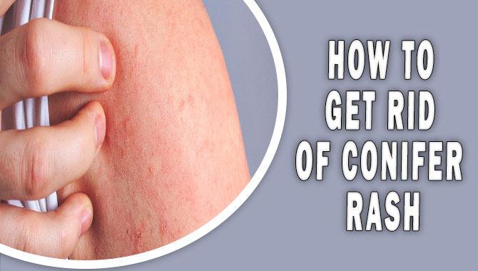 How To Get Rid Of Conifer Rash
